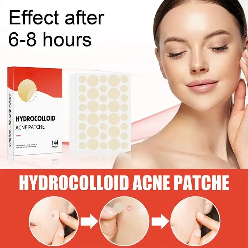 144- pices Acne Pimple Patches