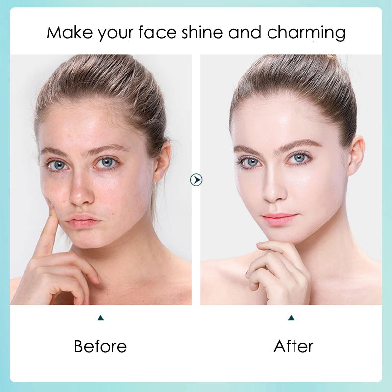10 packs Hyaluronic Acid Hydrating Sheet Masks for Face