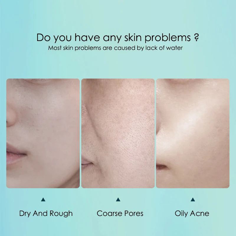 10 packs Hyaluronic Acid Hydrating Sheet Masks for Face